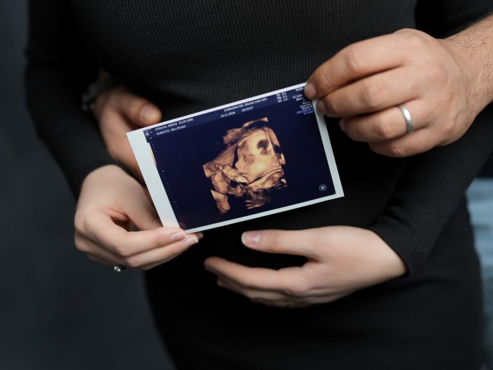 hamile pozları, hamile fotoğrafçısı, hamile stüdyo fotoğraf çekimi, hamile fotoğraf çekim fiyatları, hamile fotoğraf albümleri, hamile stüdyo çekimi, hamile çekim fiyatları,